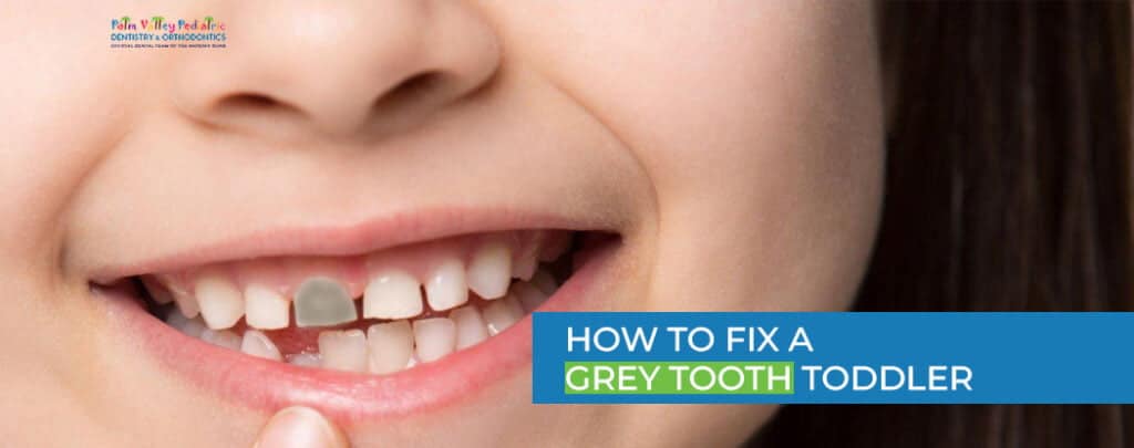 How to Fix a Grey Tooth Toddler Causes & Treatment Options - pvpd