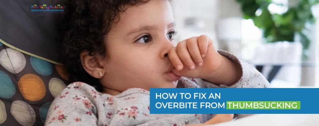 How to Fix an Overbite from Thumbsucking-pvpd