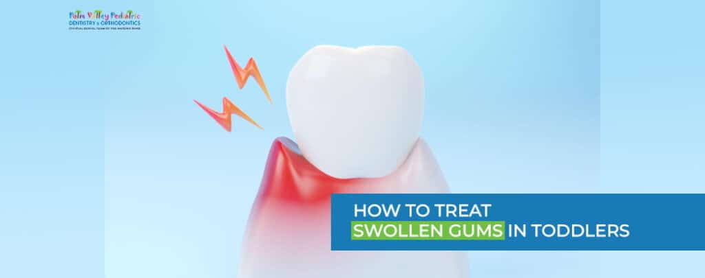 How to Treat Swollen Gums in Toddlers 7 Effective Steps - pvpd