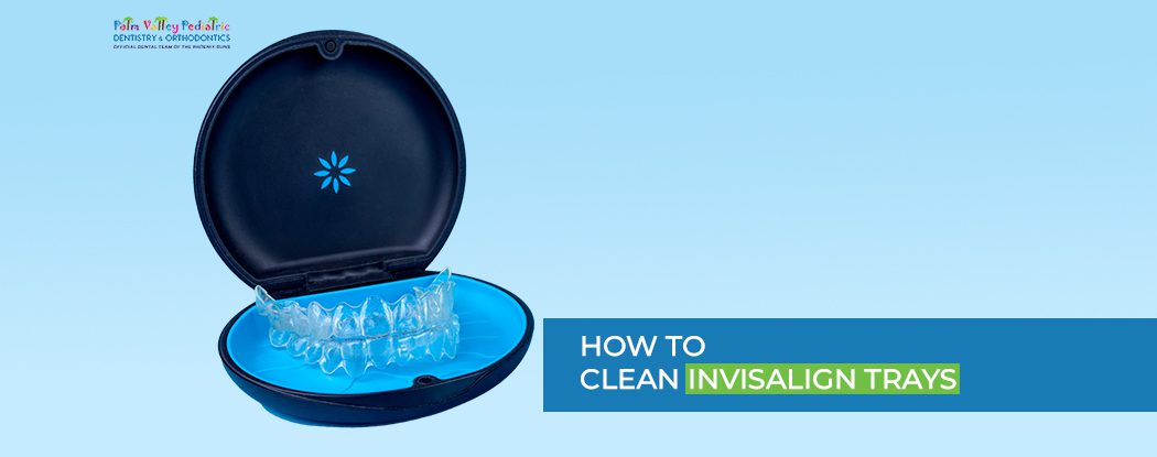 How to Clean Invisalign Trays? Best Practices, Tips & Tricks - pvpd