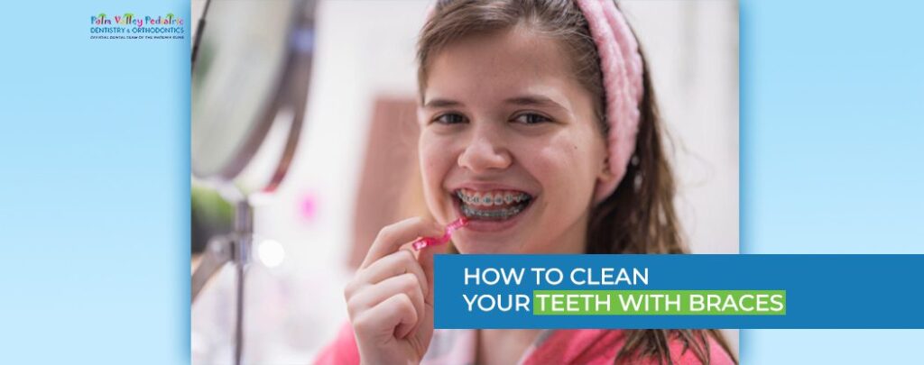 How to Clean Your Teeth with Braces? 10 Expert Advice - pvpd