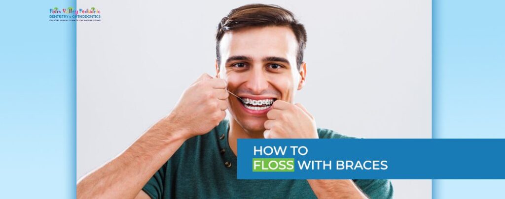 How to Floss with Braces? Different Ways, Tips & Tricks - pvpd