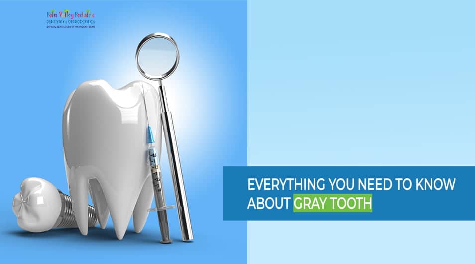 Grey Tooth: Causes, Treatment, and Prevention | PVPD