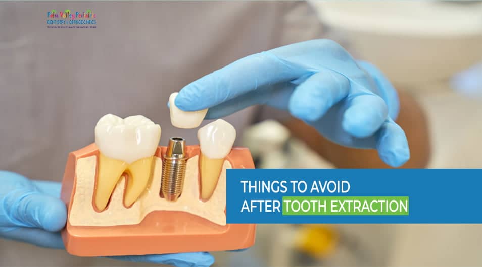 Things to Avoid After Tooth Extraction - PVPD