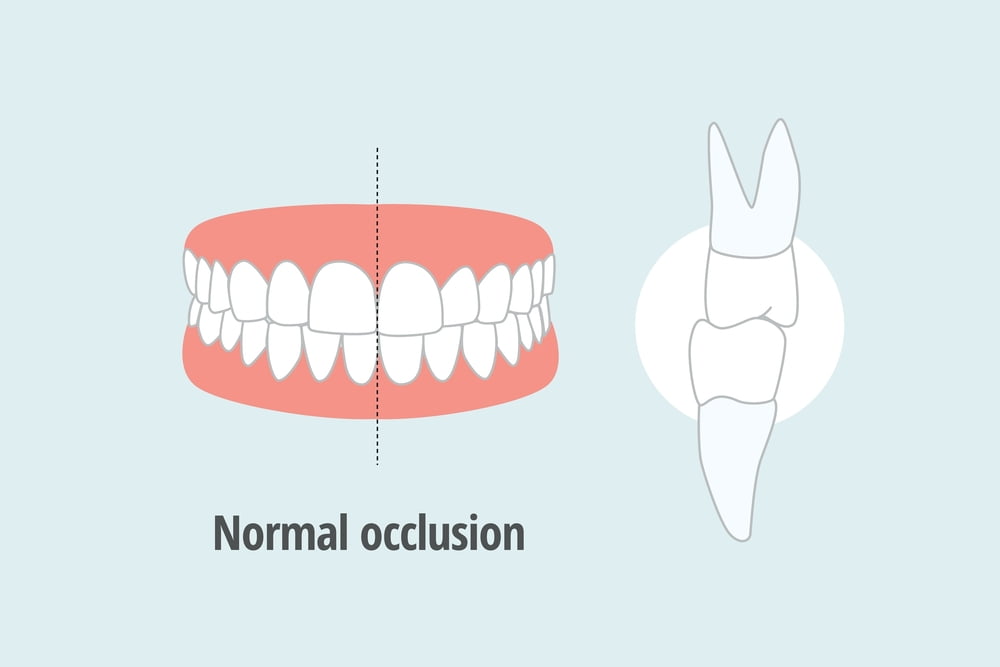 Image depicting normal occlusion, the ideal alignment of upper and lower teeth.