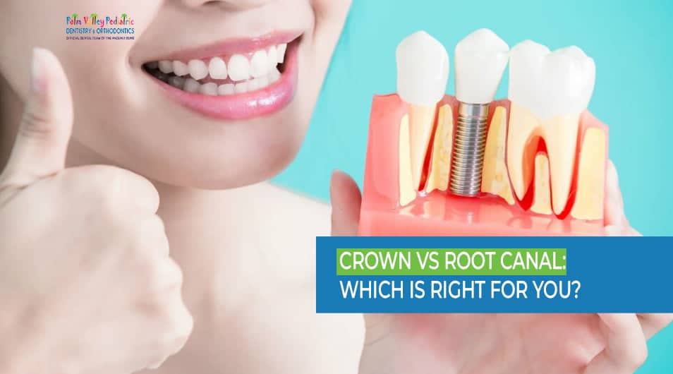 Crown vs Root Canal-pvpd