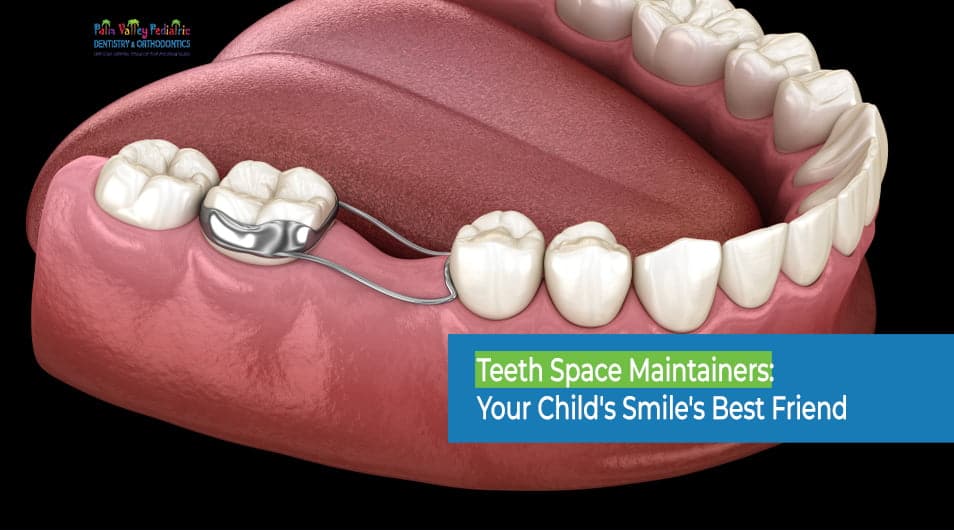 Tooth Space Maintainer: Types, Importance and Care Tips for Kids