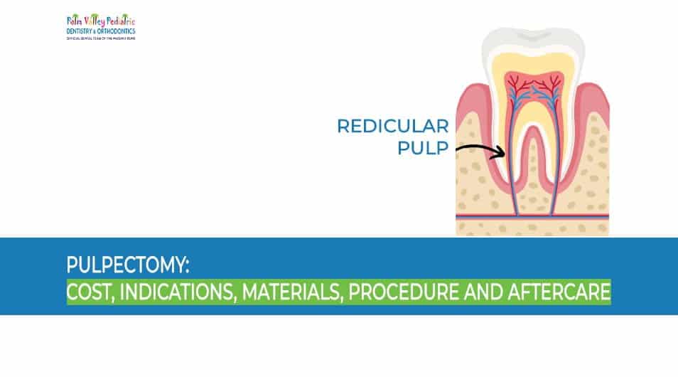 Pulpectomy: Cost, Indications, Materials, Procedure, and Aftercare - pvpd
