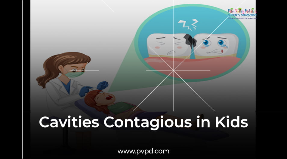 5 Ways to Prevent Cavities Contagious in Kids - PVPD
