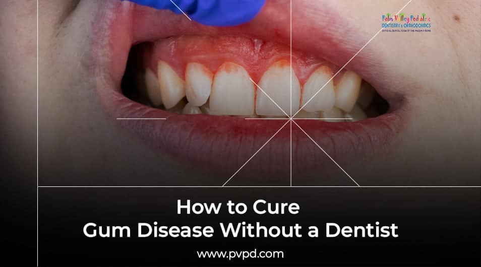 How to Cure Gum Disease Without a Dentist: Effective Remedies - PVPD