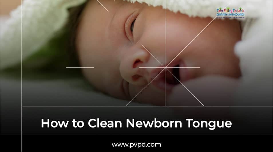 How to Clean Newborn Tongue - pvpd