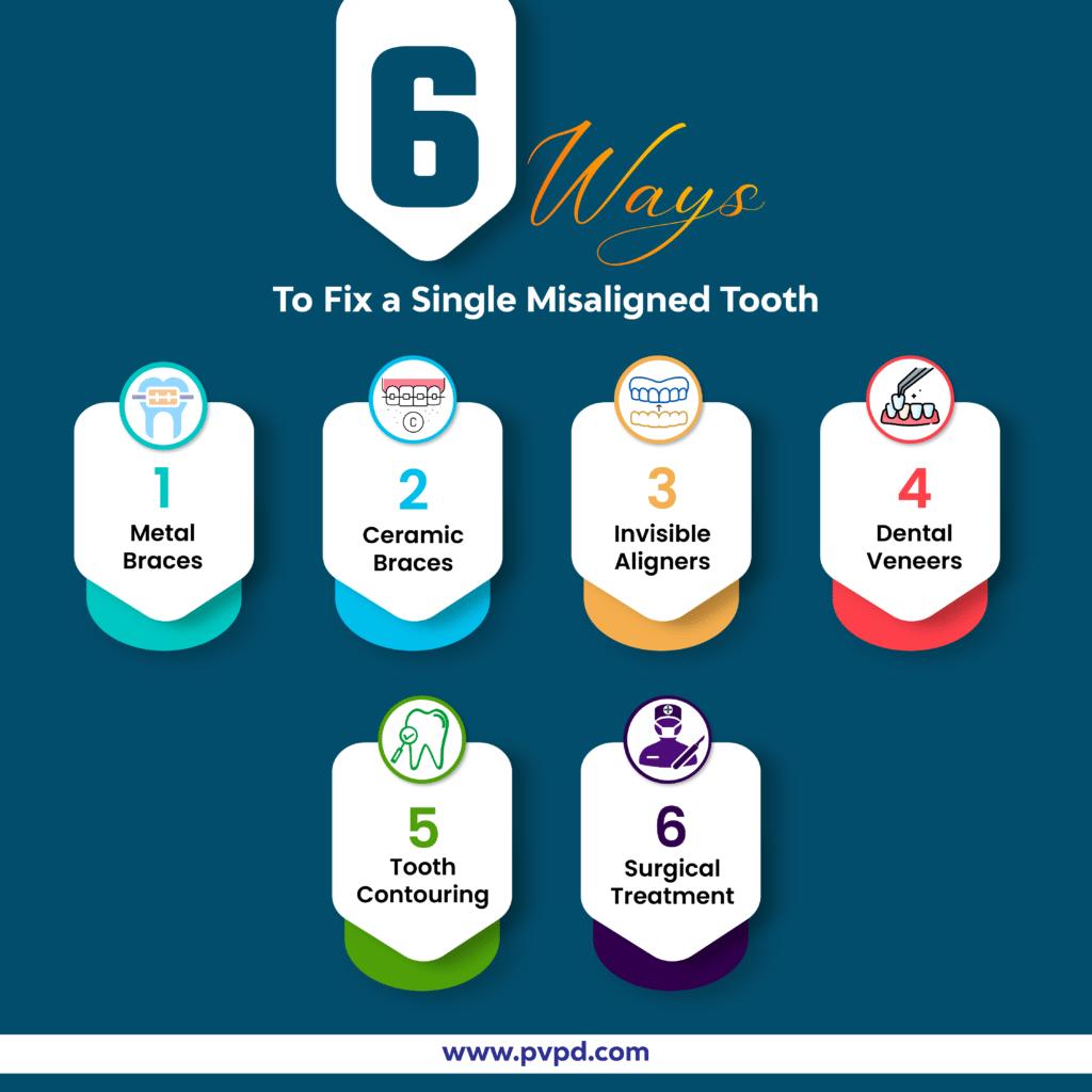 Infographic displaying 6 methods to fix a single misaligned tooth