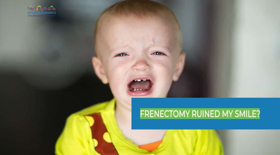 Frenectomy Ruined My Smile - Types, Procedure, Smile Impact