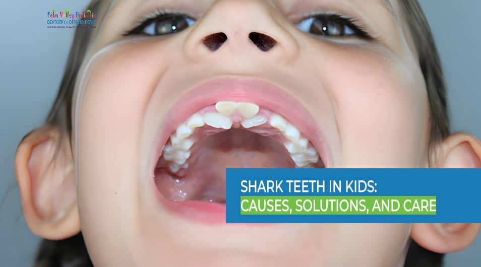 Shark Teeth in Kids: Causes, Solutions, and Dental Care
