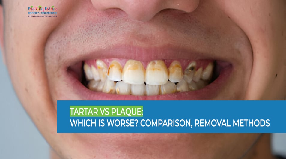 Tartar vs Plaque - Which is Worse, Comparison, Removal Methods