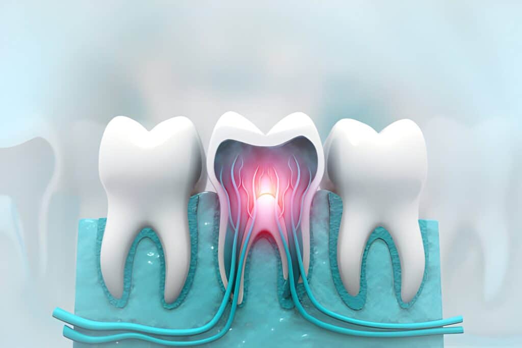 Signs of Tooth Pain Nerve