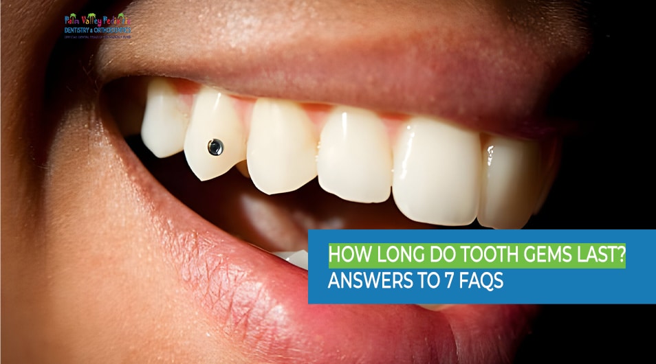 How Long Do Tooth Gems Last - Answers to 7 FAQs