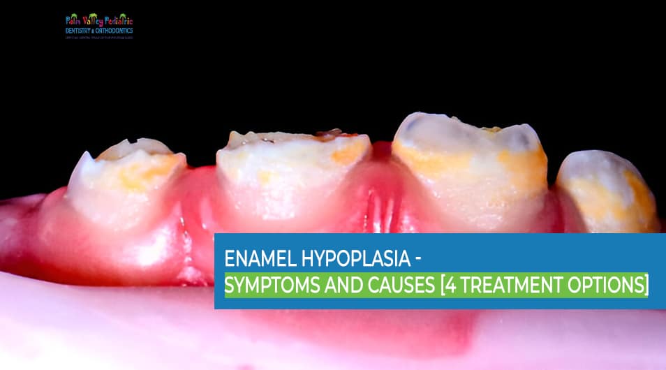 4 Effective Treatments for Enamel Hypoplasia: Symptoms & Causes