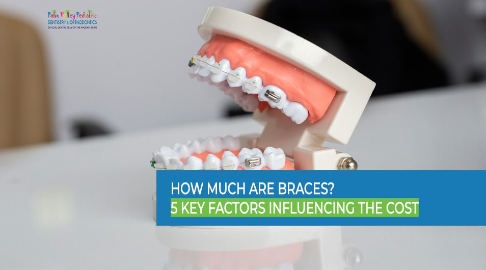 Illustration showing five key factors that affect the cost of braces, including type, treatment complexity, and location.