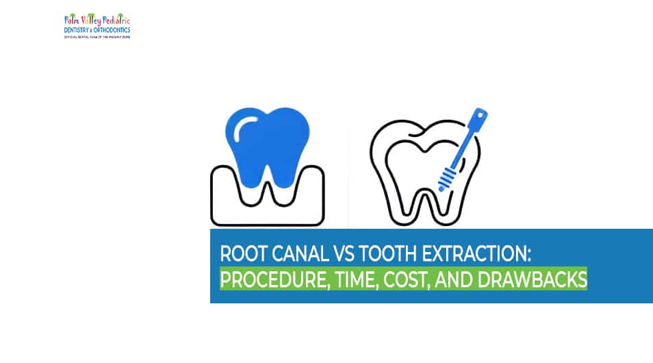 Illustration highlighting differences between Root Canal vs Tooth Extraction procedures.
