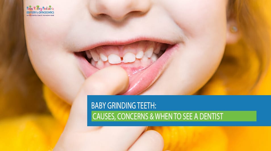 Baby grinding teeth with visible pathological bite, showing overbite and malocclusion — pediatric dentistry focus.