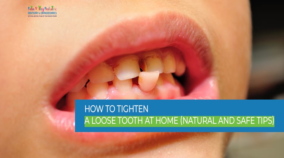 Tighten a Loose Tooth at Home Safely and Naturally