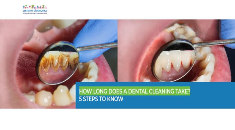 Plaque and calculus buildup removed during dental cleaning at PVPD