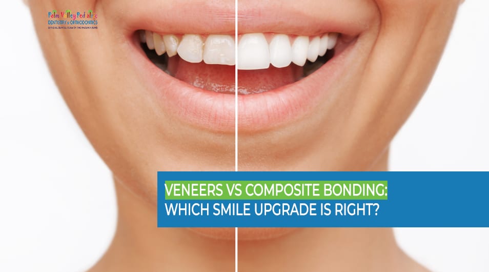 Veneers vs composite bonding before and after smile transformation