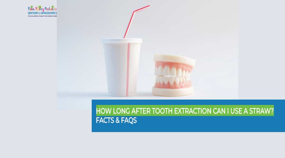 How Long After Tooth Extraction Can I Use a Straw - tooth extraction warning